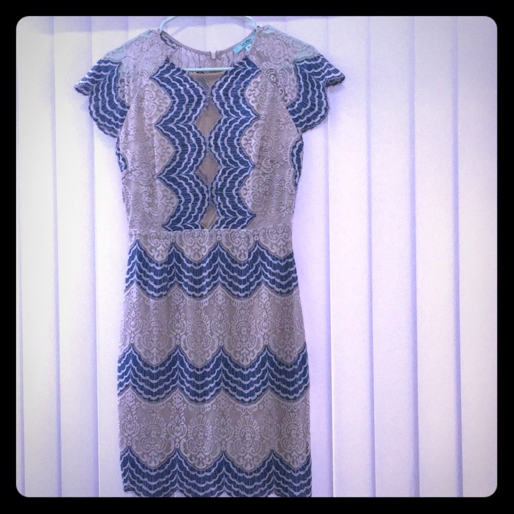 Gorgeous lace dress